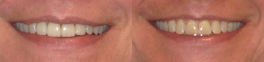 Before & After